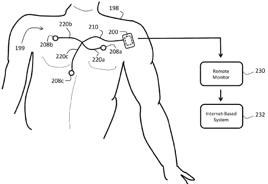 ECG Monitoring System